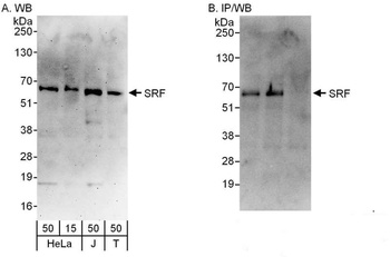 Rabbit SRF Antibody