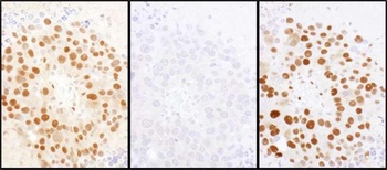 Rabbit anti-HDGF Antibody