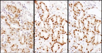 Rabbit anti-HDGF Antibody