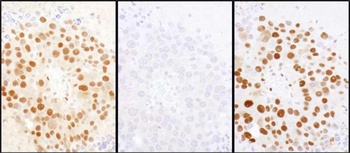 Rabbit anti-HDGF Antibody
