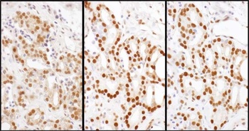 Rabbit anti-HDGF Antibody