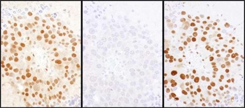 Rabbit anti-HDGF Antibody