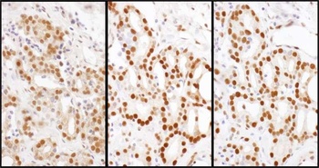 Rabbit anti-HDGF Antibody
