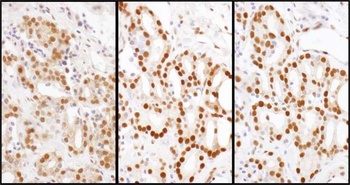 HDGF Antibody