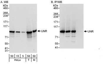 Rabbit UNR Antibody