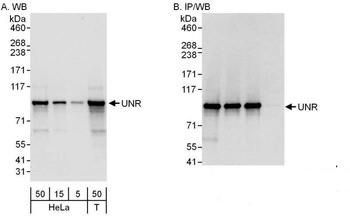 Rabbit UNR Antibody