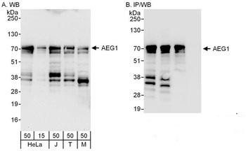 Rabbit AEG1 Antibody