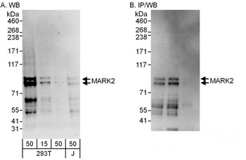 Rabbit MARK2 Antibody