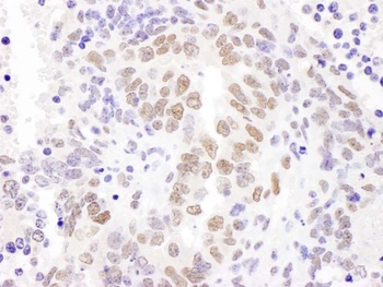 Rabbit anti-HEXIM1 Antibody