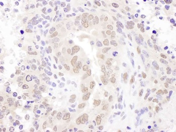 Rabbit anti-HEXIM1 Antibody