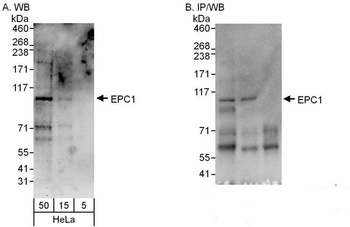 Rabbit EPC1 Antibody