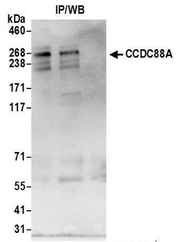 CCDC88A Antibody