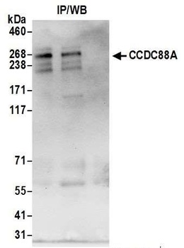 Rabbit anti-CCDC88A Antibody