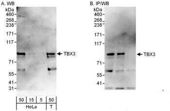 Rabbit TBX3 Antibody