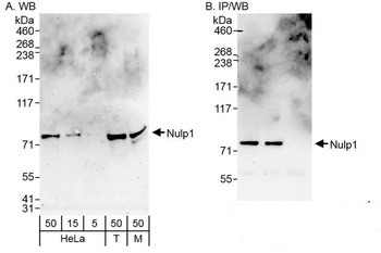 Rabbit Nulp1 Antibody