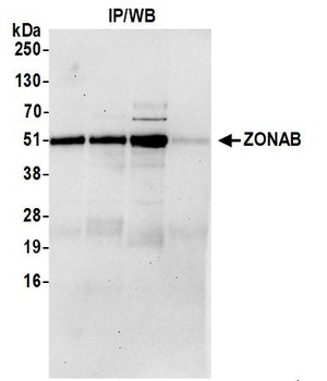 ZONAB Antibody