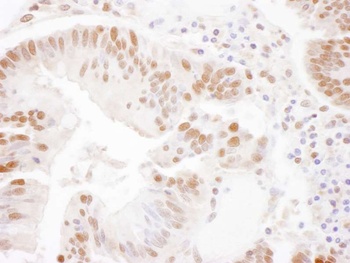 Rabbit anti-SSRP1 Antibody