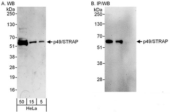 Rabbit p49/STRAP Antibody
