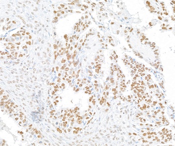 RFX1 Antibody