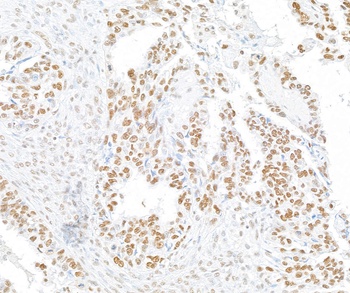 Rabbit anti-RFX1 Antibody