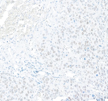 Rabbit anti-RFX1 Antibody