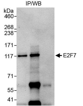 Rabbit E2F7 Antibody