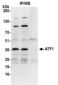 ATF1 Antibody