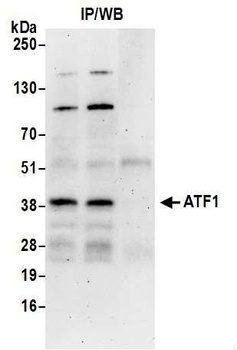 Rabbit ATF1 Antibody