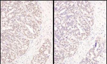 Rabbit ATF1 Antibody