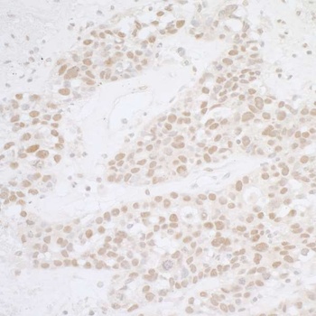 Rabbit ATF1 Antibody