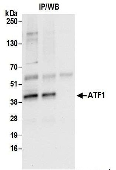Rabbit ATF1 Antibody