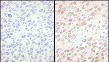Rabbit anti-eIF6 Antibody