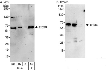 Rabbit TRM6 Antibody