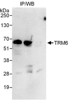 Rabbit TRM6 Antibody