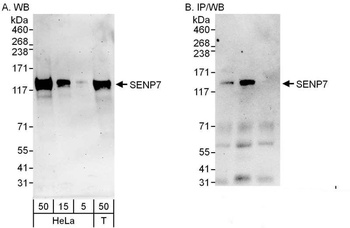 Rabbit SENP7 Antibody