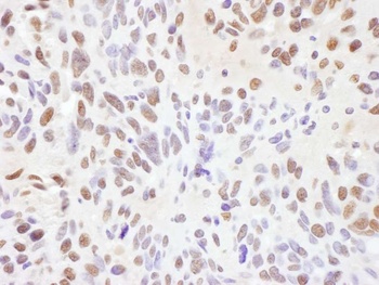 RNF138 Antibody