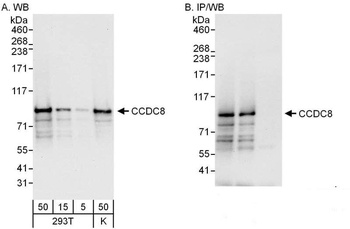Rabbit anti-CCDC8 Antibody