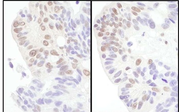Rabbit anti-eIF4AIII/EIF4A3 Antibody