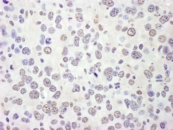 eIF4AIII/EIF4A3 Antibody