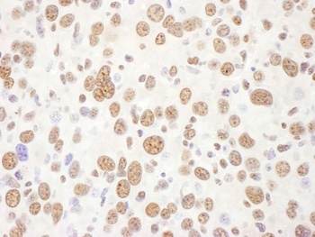 Rabbit anti-eIF4AIII/EIF4A3 Antibody