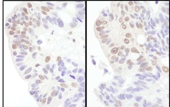 Rabbit anti-eIF4AIII/EIF4A3 Antibody