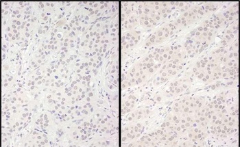 Rabbit anti-DDX56 Antibody