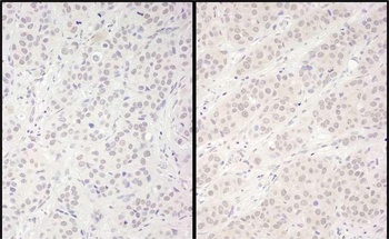 DDX56 Antibody