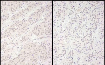 Rabbit anti-DDX56 Antibody