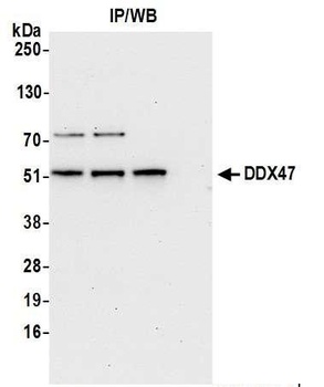 DDX47 Antibody