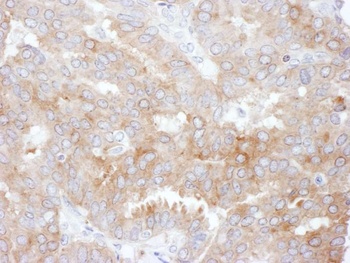 Rabbit anti-NHERF1 Antibody