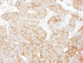 Rabbit anti-NHERF1 Antibody