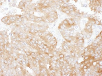 NHERF1 Antibody