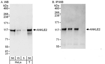 Rabbit anti-ANKLE2 Antibody