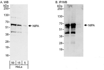 Rabbit NIPA Antibody